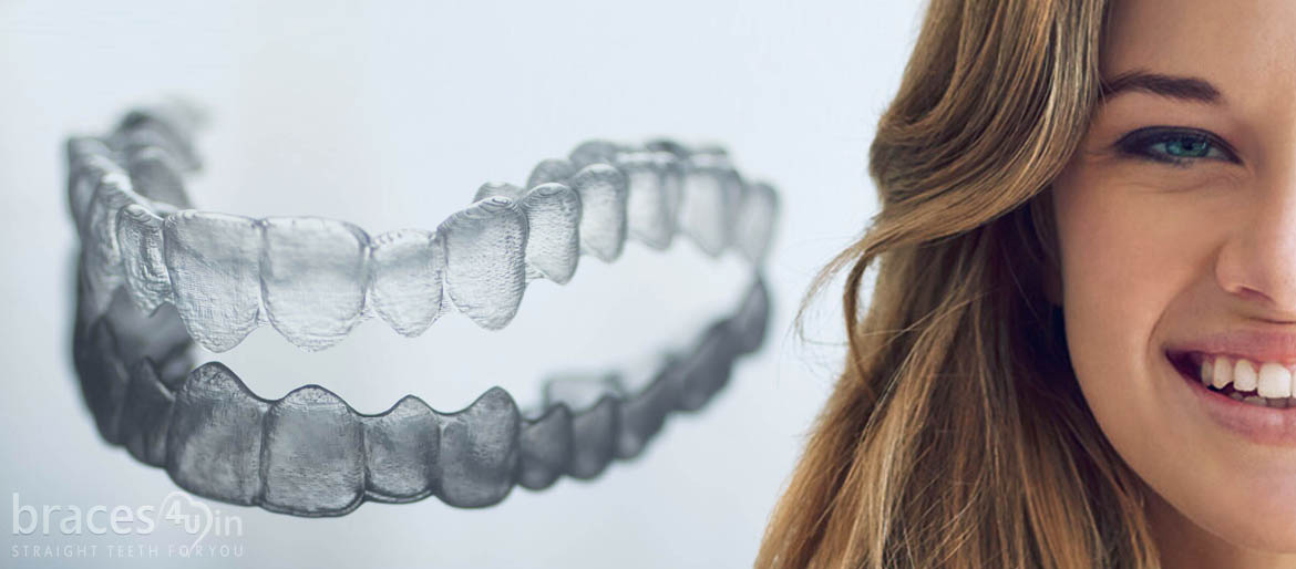 Orthodontics dental treatment clear aligners Braces4u trivandrum