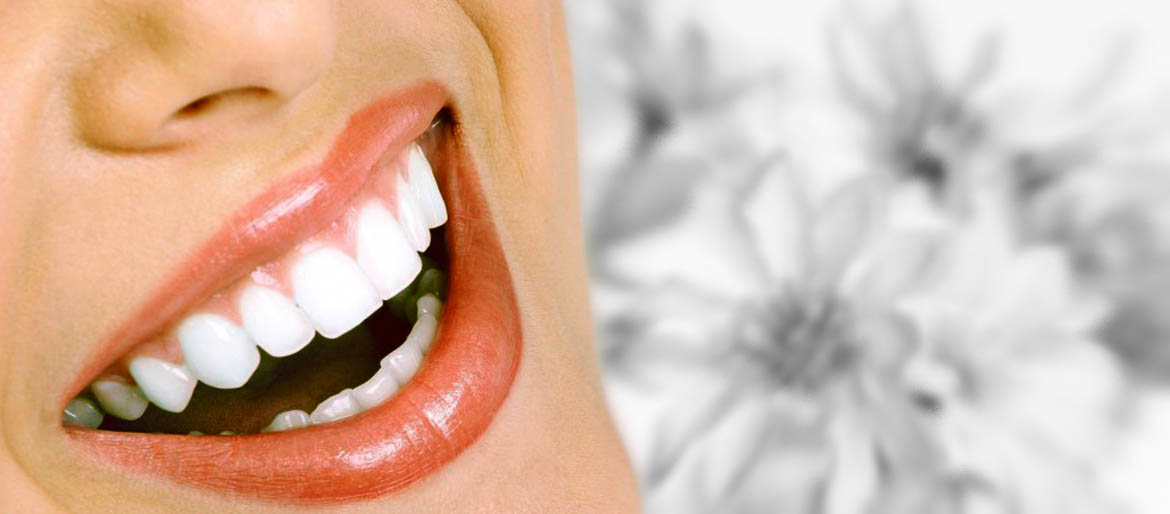 Orthodontics dental treatment Braces4u trivandrum